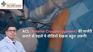 ACL (Anterior Cruciate Ligament) की सर्जरी कराने से पहले ये वीडियो देखना बहुत ज़रूरी!