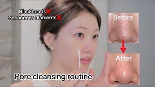 Blackheads Sebaceous filaments removal routine  all nose things