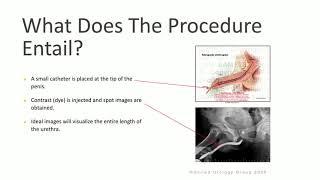 Retrograde Urethrogram & voiding Cystourethrogram