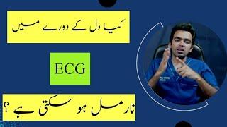 Heart Attack (Dil ka Attack) ka ilaj Kaise hota Hai Part 2/4 | ECG | troponin i t Blood Tests