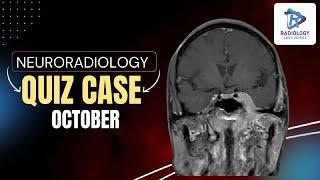 Neuroradiology Quiz case October