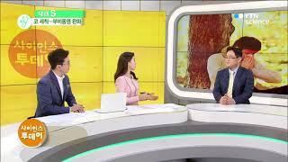 YTN 닥터S 코질환