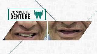 Different Dental Treatments Before and After Results at Dental Aesthetics | Cosmetic Dentistry