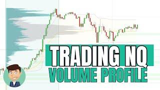 Trading NQ With Volume Profile: Strategy Explained