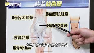 膝蓋痛不是長輩專利 揪疼痛原因"對症下藥"｜語眾不同｜來賓：林睿誠｜華視新聞 20221018