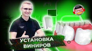 Установка виниров, когда первое протезирование зубов сделали очень плохо. Виниры - отзыв пациентки