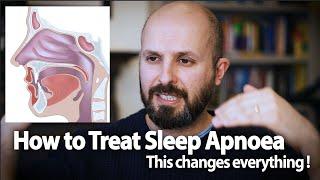 How to Treat Sleep Apnoea - This Changes Everything!