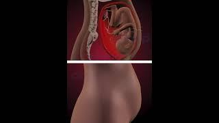 Miraculous act of Uterine contractions ( 3D Animation )