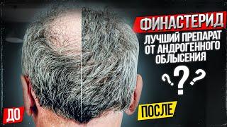 Финастерид - лучший препарат от андрогенного облысения (алопеции)?