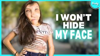 I’m Not Ashamed Of My Facial Deformity | BORN DIFFERENT