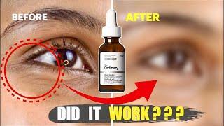 The Ordinary AGE-SUPPORT Gf15%: The Best Anti-Aging Serum?