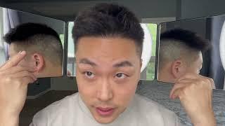 8 YEAR HAIR TRANSPLANT UPDATE + FUE SCARS!