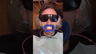 Teeth Whitening at Total Dentistry!