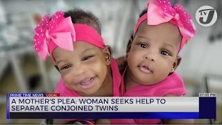 A Mother's Plea: Woman Seeks help to Separate Conjoined Twins | TVJ News