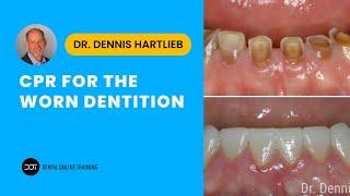 CPR for the Worn Dentition Workshop | Dental Online Training