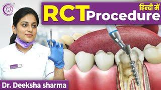 Root Canal Treatment RCT step by step Procedure | RCT करवाने से पहले जरूर देखें | #RCT #dentist