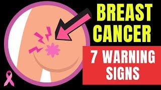 7 warning signs and symptoms of BREAST CANCER... Doctor O'Donovan explains