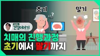 치매의 진행과정 자세히 설명드립니다. 초기에서 말기까지!  [닥터유의 건강이야기]