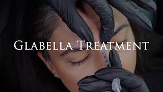 Gabella Neuromodulator Treatment