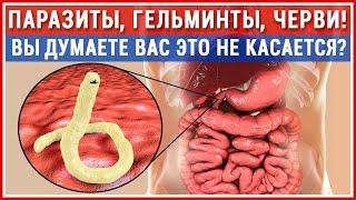 ГЛИСТЫ есть у Всех! Как изгнать паразитов? Лучшая защита. Лечение гельминтозов!