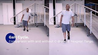 Gait cycle - Comparison with and without C-Brace® & Nexgear Tango | Ottobock