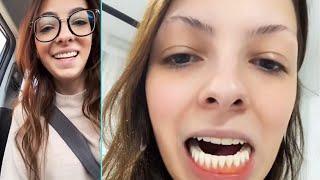 I Lost My Teeth In My 20s - The Positivity Fix