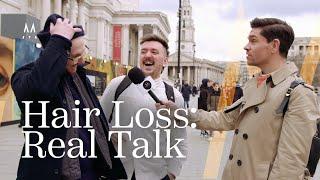 Street Talk: Men Open Up About Hair Loss!