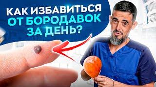 Как избавиться от папиллом и бородавок за сутки? НИКАК!