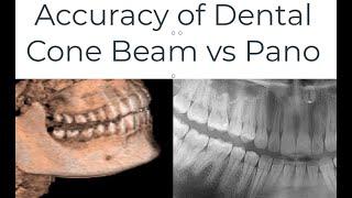 Accuracy of Dental CBCT vs Panoramic