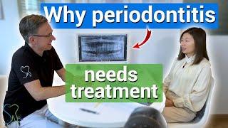 Why periodontitis needs treatment!