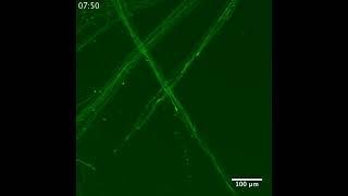 Axon Growth Cone in Organoid
