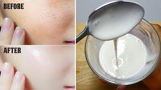 Add Just 1 Thing With Rice flour Cream And Get Full Fairness | Instant Skin Whitening Face Pack