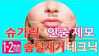 인중왁싱 슈가링으로 솜털까지 제거 蜜蜡脱毛 韩国美白  Lip waxing hair removal  sugaring