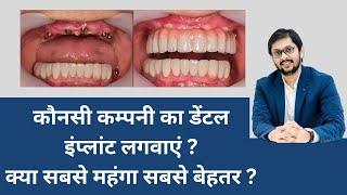 कौन सी कम्पनी का IMPLANT लगवाना चाहिए  ? Which Dental Implant companies are Best| by Seraphic Dental