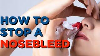 How to STOP a Nosebleed || Sleep and Sinus Centers of Georgia