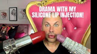 DRAMA WITH MY SILICONE LIP INJECTIONS! DRAG QUEEN ON BOTCHED AND THE JOURNEY OF THE INJECTION!