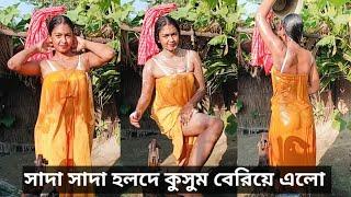 সাদা সাদা হলদে কুসুম বেরিয়ে এলো। #dailyvlog #banglavlog #lifestylevlog #vlogvideo #youtubevideo