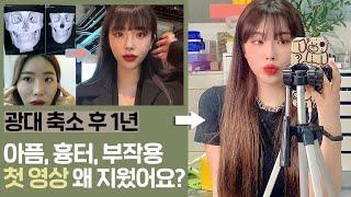 Q&A 광대 수술 후 1년이 지났어요! 아픔, 흉터, 부작용 등 모든내용을 넣었습니다 ! 그리고 이제 더이상,,, | 달리아 daHlia 