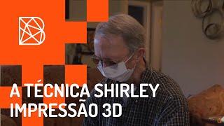 A técnica Shirley, um sobrevivente do câncer recebe uma nova prótese impressa em 3D