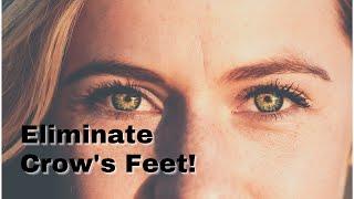 Natural Home Remedies for Crow's Feet