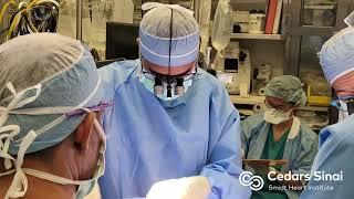 Case Numbers | Cedars-Sinai Thoracic Surgery—Integrated Residency