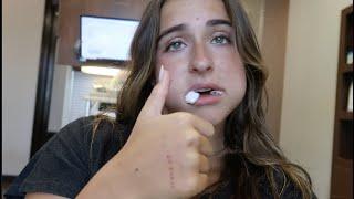 I Got My Wisdom Teeth Removed!!! VLOG