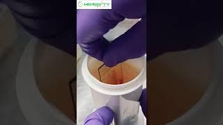 Ziehl–Neelsen staining #hereditybioacademy #reels