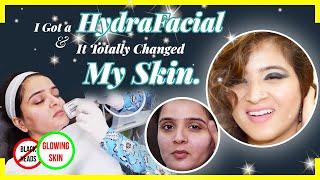 My Hydrafacial Experience | Get GLOWING Clear Skin! | Makeup Musings