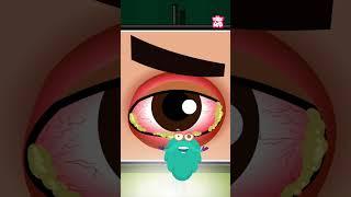 What Is Pink Eye? What Causes Conjunctivitis #shorts #pinkeye #conjunctivitis #drbinocsshow