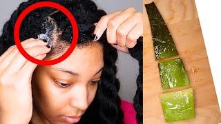 9 WAYS TO USE ALOE VERA GEL FOR HAIR GROWTH | GET THICKER HAIR