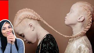 10 أطفال لن تصدقوا وجودهم! سبحان الله 