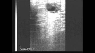 BCF Technology Ultrasonography of the bovine reproductive tract video 8 - Ultrasound clip