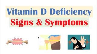 Vitamin D Deficiency Signs & Symptoms (ex. Fatigue), Diagnosis, Treatment