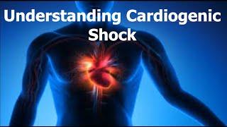 Understanding Cardiogenic Shock